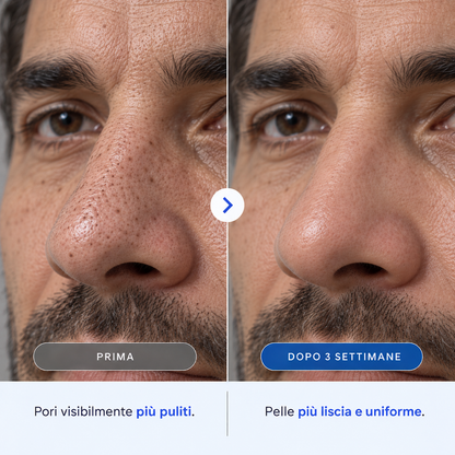 Maschera Zero Pori & Punti Neri Porexia™