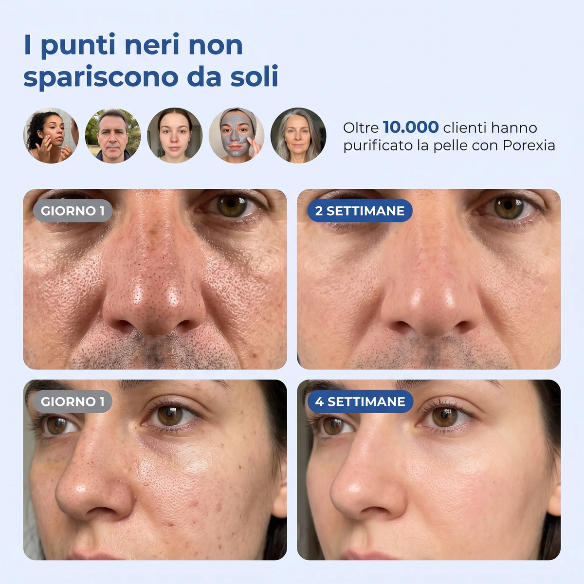 Maschera Zero Pori & Punti Neri Porexia™