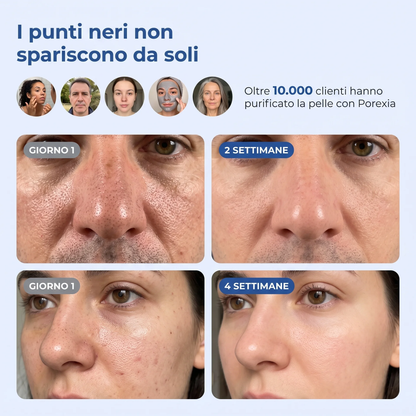 Maschera Zero Pori & Punti Neri Porexia™
