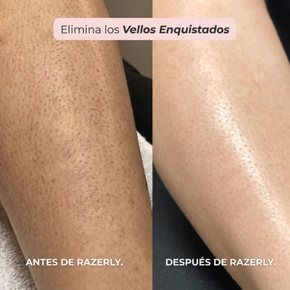 Maquinilla 2 en 1 para Bikini y Cuerpo Razerly™