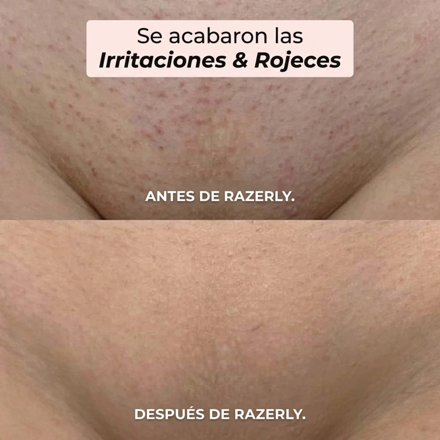 Maquinilla 2 en 1 para Bikini y Cuerpo Razerly™