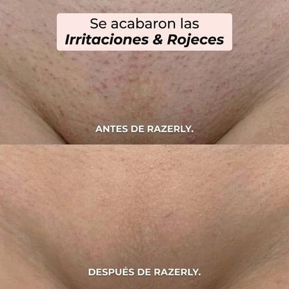 Maquinilla 2 en 1 para Bikini y Cuerpo Razerly™