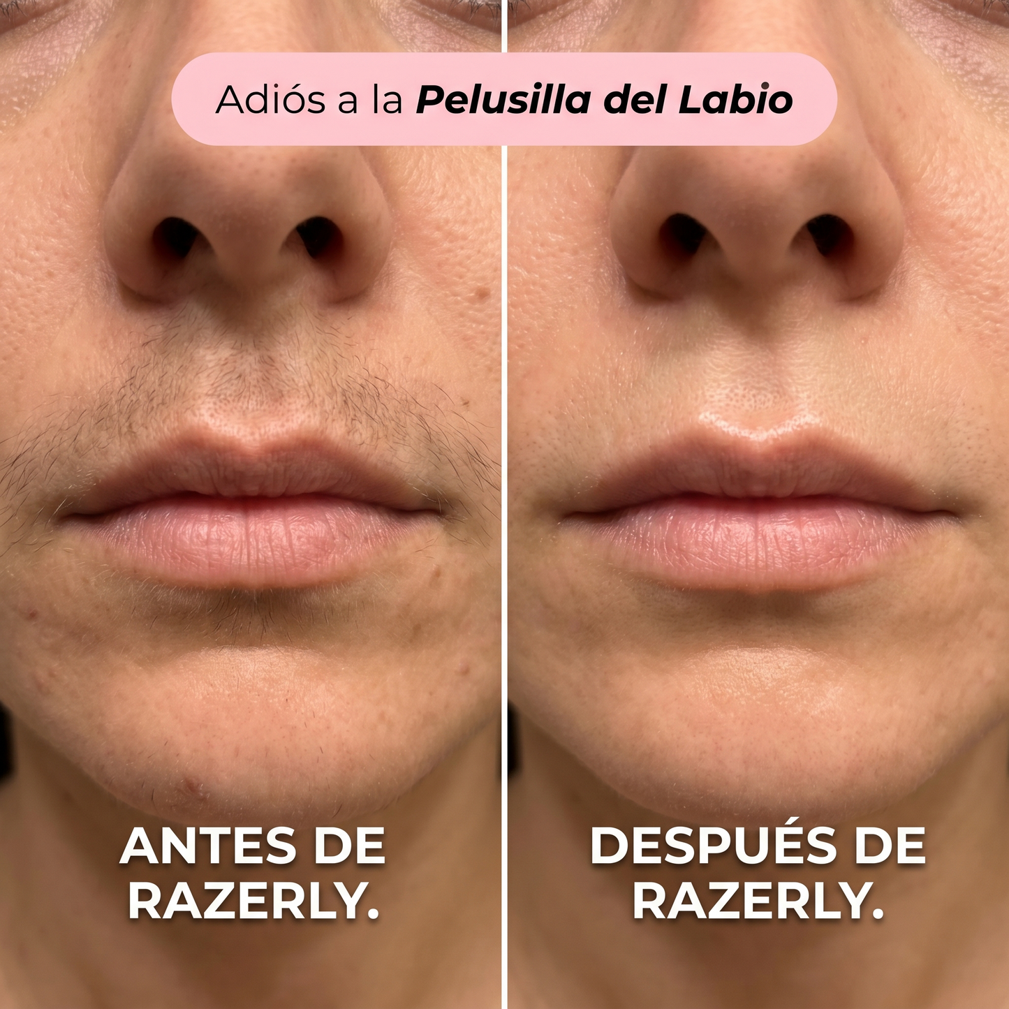 Maquinilla Eléctrica Facial 2 En 1 Razerly™