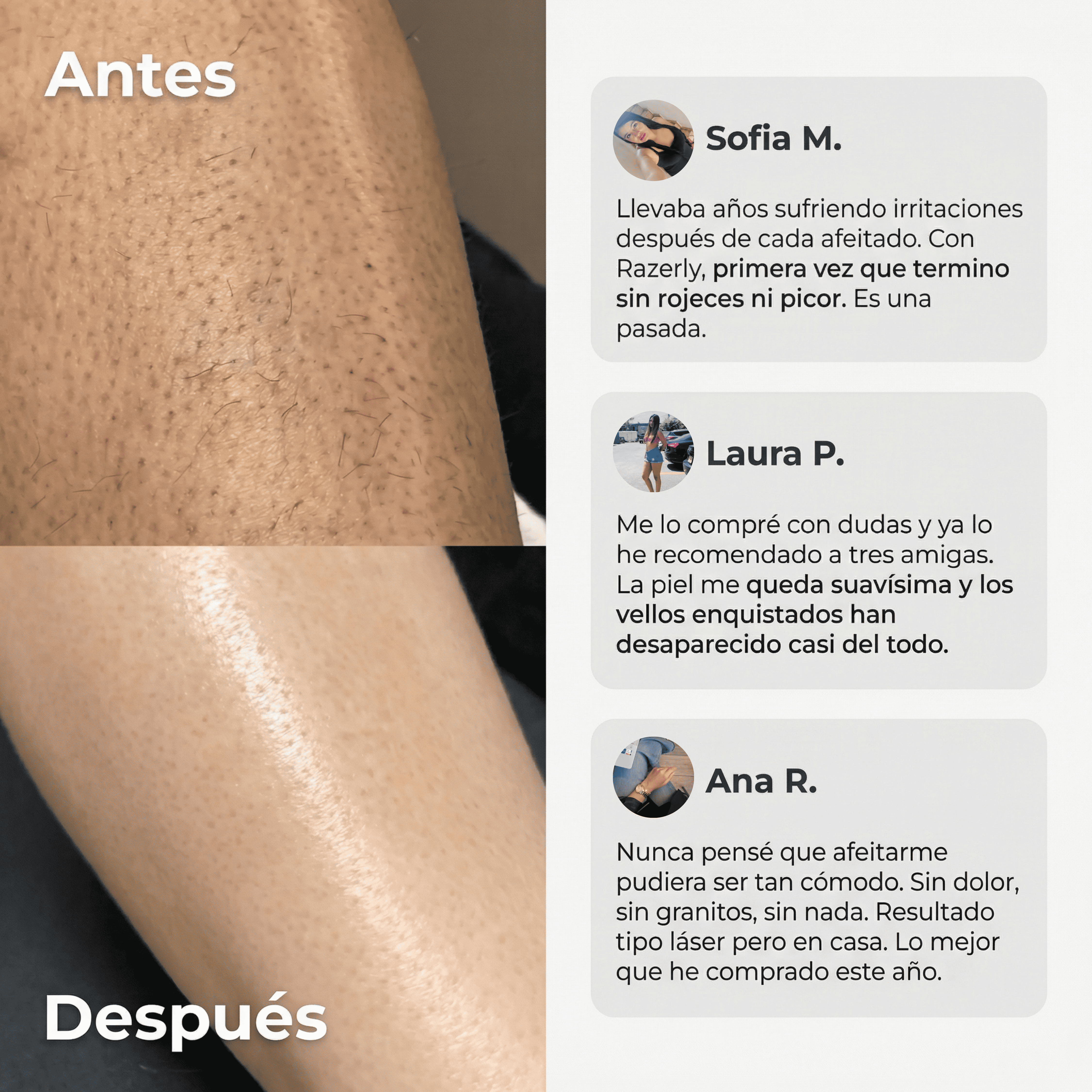 Contenido del kit depiladora